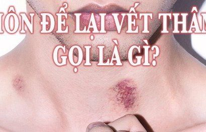 Hôn để lại vết thâm gọi là gì?